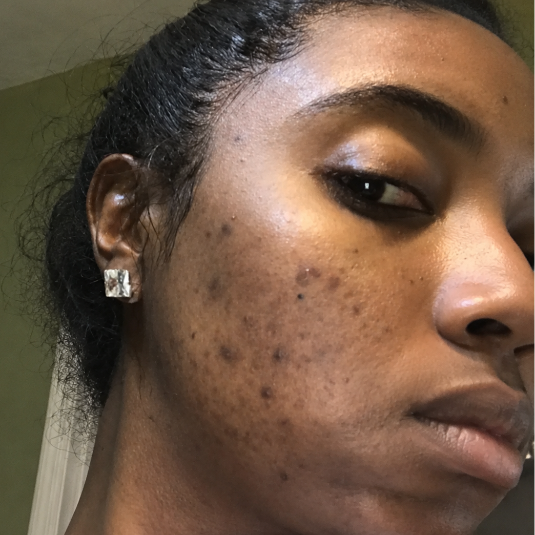 Skin appearance before use
