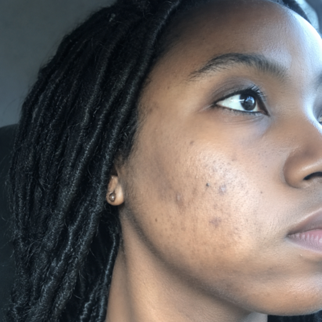 Skin appearance after use